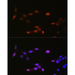 Dimethyl-Histone H3-K14 Antibody