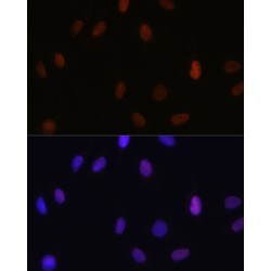 Dimethyl-Histone H3-K14 Antibody