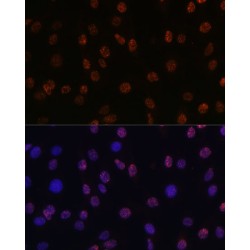 Trimethyl-Histone H3-K14 Antibody