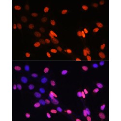Trimethyl-Histone H3-K14 Antibody