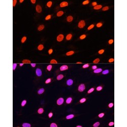 Histone H3(mono+di+methyl K79) Antibody