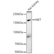 Western blot analysis of lysates from Rat kidney, using MET Antibody at 1/500 dilution. Secondary antibody: HRP-conjugated Goat anti-Rabbit IgG (H+L) at 1/10000 dilution. Lysates/proteins: 25 µg per lane. Blocking buffer: 3% nonfat dry milk in TBST. Exposure time: 60s.