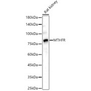 Western blot analysis of lysates from Rat kidney, using MTHFR Antibody at 1/2000 dilution. Secondary antibody: HRP-conjugated Goat anti-Rabbit IgG (H+L) at 1/10000 dilution. Lysates/proteins: 25 µg per lane. Blocking buffer: 3% nonfat dry milk in TBST. Exposure time: 180s.