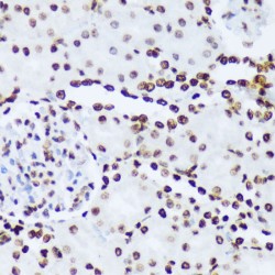 ABL1 (pY245) Antibody