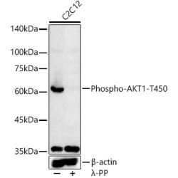 RAC-Alpha Serine/threonine-Protein Kinase Phospho-Thr450 (AKT1 pT450) Antibody
