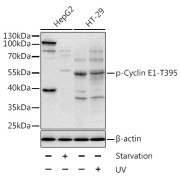Western blot analysis of various lysates using Phospho-Cyclin E1-T395 Antibody. Secondary antibody: HRP-conjugated Goat anti-Rabbit IgG (H+L) at 1/10000 dilution. Lysates/proteins: 25 µg per lane. Blocking buffer: 3% BSA.