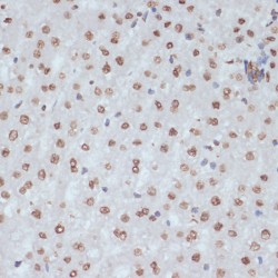 Cyclin Dependent Kinase 1 Phospho-Tyr15 (CDK1 pY15) Antibody
