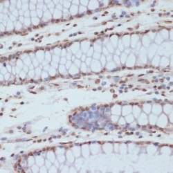 Cyclin Dependent Kinase 1 Phospho-Tyr15 (CDK1 pY15) Antibody