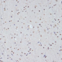 Cyclin Dependent Kinase 1 Phospho-Tyr15 (CDK1 pY15) Antibody