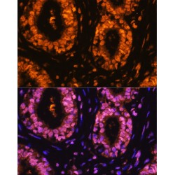 Cyclin Dependent Kinase 1 Phospho-Tyr15 (CDK1 pY15) Antibody