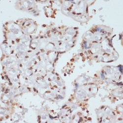 CHEK1 (pS280) Antibody