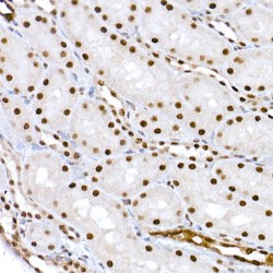 CREB (pS133) Antibody