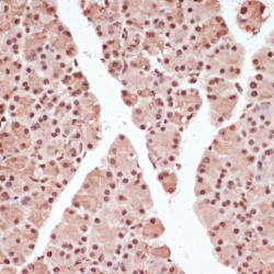 ATF2 (pT53) Antibody