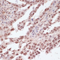 ATF2 (pT53) Antibody