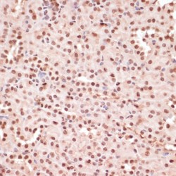 ATF2 (pT53) Antibody