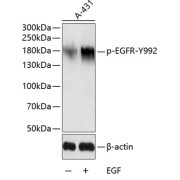 abx000115