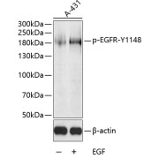 abx000116