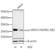 Western blot analysis of lysates from HeLa cells, using Phospho-HSP27/HSPB1-S82 Antibody at 1/1000 dilution. HeLa cells were treated by EGF (100ng/ml) for 30 minutes after serum-starvation overnight. Secondary antibody: HRP-conjugated Goat anti-Rabbit IgG (H+L) at 1/10000 dilution. Lysates/proteins: 25 µg per lane. Blocking buffer: 3% BSA. Exposure time: 1min.