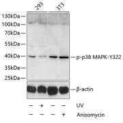 Western blot analysis of lysates from 293 and NIH/3T3 cells, using Phospho-p38 MAPK-Y322 Antibody at 1/1000 dilution. 293 cells were treated by UV for 15-30 minutes. NIH/3T3 cells were treated by Anisomycin (25 µg/ml) for 30 minutes. Secondary antibody: HRP-conjugated Goat anti-Rabbit IgG (H+L) at 1/10000 dilution. Lysates/proteins: 25 µg per lane. Blocking buffer: 3% BSA. Exposure time: 15s.