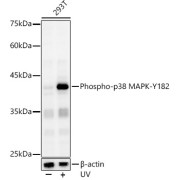 abx000139