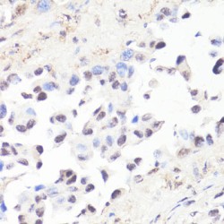 MYC (pT58) Antibody