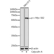 Western blot analysis of lysates from NIH/3T3 cells, using Phospho-c-Myc-S62 Antibody at 1/1000 dilution. NIH/3T3 cells were treated by Calyculin A (100 nM) at 37 °C for 30 minutes after serum-starvation overnight. Secondary antibody: HRP-conjugated Goat anti-Rabbit IgG (H+L) at 1/10000 dilution. Lysates/proteins: 25 µg per lane. Blocking buffer: 3% nonfat dry milk in TBST. Exposure time: 60s.