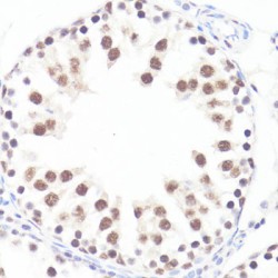 MYC (pS62) Antibody