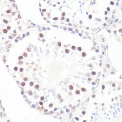 MYC (pS62) Antibody