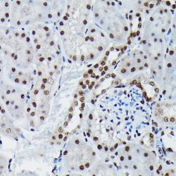 JUN (pS73) Antibody