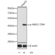 abx000173