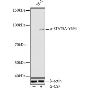 Western blot analysis of lysates from TF-1 cells, using Phospho-STAT5A-Y694 Antibody at 1/1000 dilution. TF-1 cells were treated by G-CSF (25 ng/ml) at 37 °C for 30 minutes after serum-starvation overnight. Secondary antibody: HRP-conjugated Goat anti-Rabbit IgG (H+L) at 1/10000 dilution. Lysates/proteins: 25 µg per lane. Blocking buffer: 3% nonfat dry milk in TBST. Exposure time: 180s.
