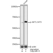 abx000192