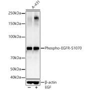 abx000205