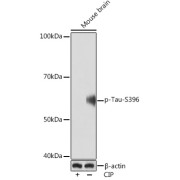 WB analysis of Mouse brain tissue lysate (25 μg) treated with CIP (20 μl/400 μl, 37°C for 1 hour) using Microtubule-Associated Protein Tau Phospho-Ser396 (MAPT pS396) Antibody (1/1000 dilution) and <a href="https://www.abbexa.com/index.php?route=product/search&search=abx005548 " target="_blank">abx005548</a> - HRP-conjugated Goat Anti-Rabbit IgG H&L Antibody (1/10000 dilution).