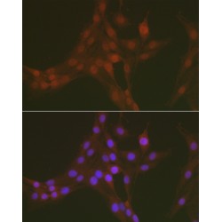 Forkhead Box Protein O1 Phospho-Ser256 (FOXO1 pS256) Antibody