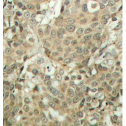 CFL1 (pS3) Antibody