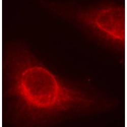 CFL1 (pS3) Antibody