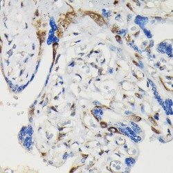 Vasodilator Stimulated Phosphoprotein Phospho-Ser239 (VASP pS239) Antibody