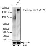 Western blot analysis of lysates from A-431 cells, using Phospho-EGFR-Y1172 Antibody at 1/500 dilution. A-431 cells were treated by EGF (100 ng/ml) at 37 °C for 30 minutes after serum-starvation overnight. Secondary antibody: HRP-conjugated Goat anti-Rabbit IgG (H+L) at 1/10000 dilution. Lysates/proteins: 25 µg per lane. Blocking buffer: 3% nonfat dry milk in TBST. Exposure time: 60s.