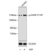 abx000275