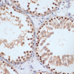 Breast Cancer Type 1 Susceptibility Protein Phospho-Ser1423 (BRCA1 pS1423) Antibody
