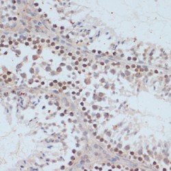 Breast Cancer Type 1 Susceptibility Protein Phospho-Ser1423 (BRCA1 pS1423) Antibody