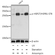 Western blot analysis of lysates from HeLa cells, using Phospho-HSP27/HSPB1-S78 Antibody at 1/1000 dilution. HeLa cells were treated by UV for 15-30 minutes or treated by serum-starvation overnight or treated by Anisomycin (25 µg/ml) for 30 minutes after serum-starvation overnight. Secondary antibody: HRP-conjugated Goat anti-Rabbit IgG (H+L) at 1/10000 dilution. Lysates/proteins: 25 µg per lane. Blocking buffer: 3% BSA. Exposure time: 30s.