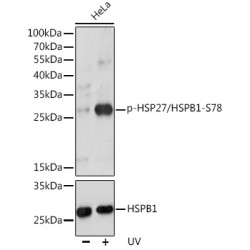 HSPB1 (pS78) Antibody