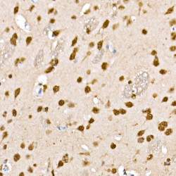 HDAC4 / 5 / 9 (pS246 / 259 / 220) Antibody