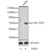 Western blot analysis of lysates from Jurkat cells using Phospho-Syk-Y323 Antibody. Secondary antibody: HRP-conjugated Goat anti-Rabbit IgG (H+L) at 1/10000 dilution. Lysates/proteins: 25 µg per lane. Blocking buffer: 3% BSA.