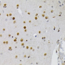CREB1 (pS133) Antibody