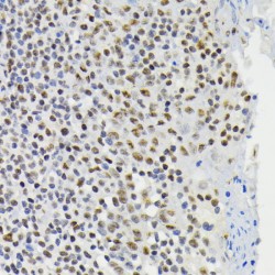 CREB1 (pS133) Antibody