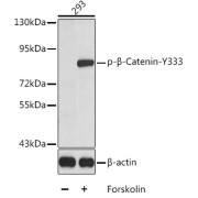 Western blot analysis of lysates from 293 cells, using Phospho-β-Catenin-Y333 Antibody. Secondary antibody: HRP-conjugated Goat anti-Rabbit IgG (H+L) at 1/10000 dilution. Lysates/proteins: 25 µg per lane. Blocking buffer: 3% BSA.