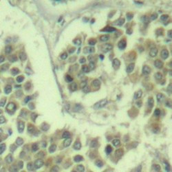 EIF2S1 (pS49) Antibody